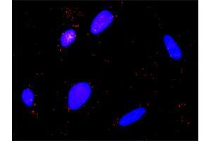 Proximity Ligation Analysis of protein-protein interactions between CAPN1 and F2R. (CAPNL1 抗体  (AA 1-714))