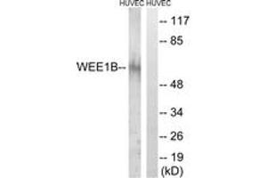 Western blot analysis of extracts from HuvEc cells, using WEE2 Antibody. (WEE2 抗体  (AA 151-200))