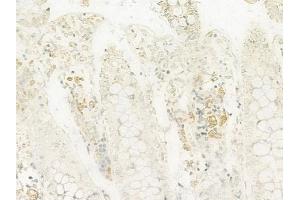 ABIN6263809 and ABIN6272371 at 1/100 staining human normal colon tissue by IHC-P.