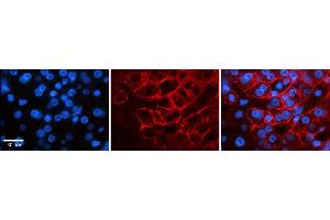 Immunohistochemistry (IHC) image for anti-Sodium Channel, Voltage-Gated, Type VIII, alpha (SCN8A) (C-Term) antibody (ABIN2776200)