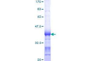 Image no. 1 for Salt-Inducible Kinase 2 (SIK2) (AA 467-576) protein (GST tag) (ABIN1320006)