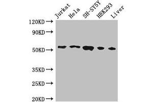 Western Blot Positive WB detected in: Jurkat whole cell lysate, Hela whole cell lysate, SH-SY5Y whole cell lysate, HEK293 whole cell lysate, Mouse liver tissue All lanes: FKBP8 antibody at 3 μg/mL Secondary Goat polyclonal to rabbit IgG at 1/50000 dilution Predicted band size: 45, 28 kDa Observed band size: 55 kDa