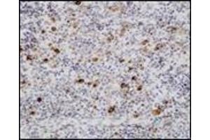 Immunohistochemistry (IHC) image for anti-Epstein-Barr Virus (EBV) (Internal Region) antibody (ABIN870464) (EBV 抗体  (Internal Region))