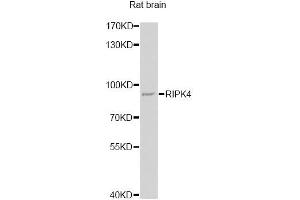 Western blot analysis of extracts of rat brain, using RIPK4 antibody (ABIN6292235) at 1:1000 dilution. (RIPK4 抗体)