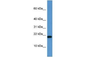 WB Suggested Anti-SH2D1A  Antibody Titration: 0. (SH2D1A 抗体  (C-Term))