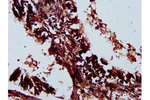 IHC image of ABIN7158256 diluted at 1:300 and staining in paraffin-embedded human lung tissue performed on a Leica BondTM system.