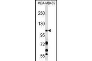 PIK3CB Antibody (N-term ) (ABIN652426 and ABIN2842105) western blot analysis in MDA-M cell line lysates (35 μg/lane). (PIK3CB 抗体  (N-Term))