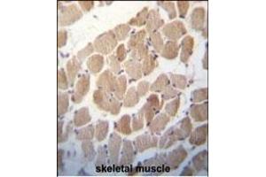 RUVBL1 (TIP49) Antibody (Center) (ABIN650670 and ABIN2850421) immunohistochemistry analysis in formalin fixed and paraffin embedded human skeletal muscle followed by peroxidase conjugation of the secondary antibody and DAB staining. (RUVBL1 抗体  (AA 247-280))