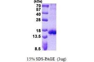 Figure annotation denotes ug of protein loaded and % gel used. (CTLA4 蛋白)
