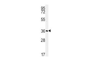 Western Blotting (WB) image for anti-ATPase, Na+/K+ Transporting, beta 1 Polypeptide (ATP1B1) (AA 112-138) antibody (ABIN652047)