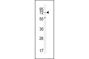 SLFN12L Antibody (N-term) (ABIN654871 and ABIN2844529) western blot analysis in Jurkat cell line lysates (35 μg/lane). (SLFN12L 抗体  (N-Term))