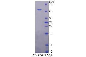 SDS-PAGE analysis of Human TNNC1 Protein. (TNNC1 蛋白)
