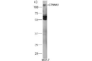 Human MCF-7 lysates probed with Rabbit Anti-Alpha Catenin/CTNNA1 Polyclonal Antibody, Unconjugated (ABIN731813) at 1:300 overnight at 4˚C. (CTNNA1 抗体  (AA 801-906))