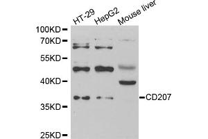 Western blot analysis of extracts of various cell lines, using CD207 antibody. (CD207 抗体)