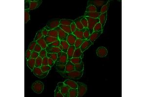 Confocal Immunofluorescence of MCF-7 cells EpCAM Mouse Monoclonal Antibody (EGP40/1373). (EpCAM 抗体  (Extracellular Domain))