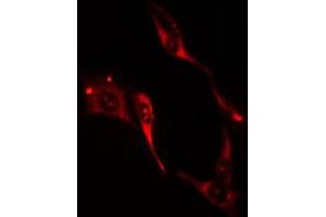 ABIN6274205 staining HuvEc cells by IF/ICC. (ITPKA 抗体  (N-Term))