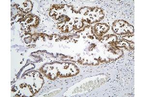 IHC analysis of PHF21A using anti-PHF21A antibody (ABIN6719353). (PHF21A 抗体  (AA 1-97))