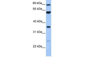 CCDC7 antibody used at 1 ug/ml to detect target protein. (CCDC7 抗体  (N-Term))