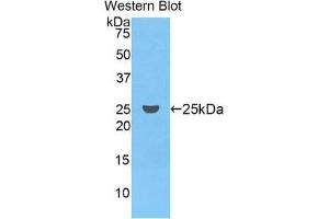 Western Blotting (WB) image for anti-Coagulation Factor IX (F9) (AA 61-263) antibody (ABIN1858770) (Coagulation Factor IX 抗体  (AA 61-263))