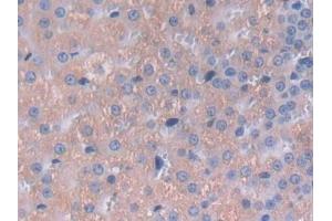 Immunohistochemistry (IHC) image for anti-Interleukin 12 alpha (IL12A) (AA 23-215) antibody (ABIN7430657)