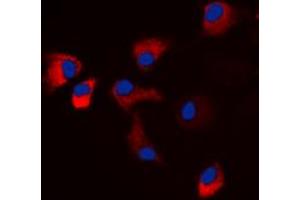 Immunofluorescent analysis of CaMK2 alpha/delta (pT286) staining in HeLa cells. (CaMK2 alpha/delta 抗体  (pSer286))