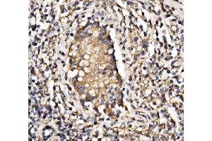 IHC analysis of PI 3 Kinase p85 alpha/PIK3R1 using anti-PI 3 Kinase p85 alpha/PIK3R1 antibody (ABIN7599781).