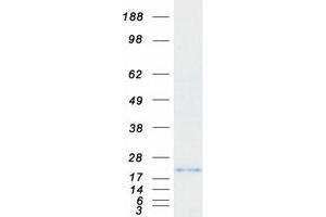Western Blotting (WB) image for Cysteine and Glycine-Rich Protein 2 (CSRP2) protein (Myc-DYKDDDDK Tag) (ABIN2712585)