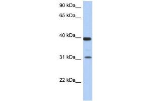 RPSA antibody used at 1 ug/ml to detect target protein. (RPSA/Laminin Receptor 抗体  (Middle Region))