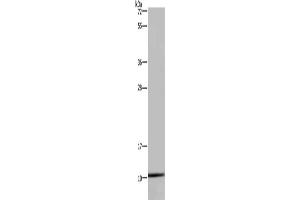 Gel: 10 % SDS-PAGE, Lysate: 40 μg, Lane: Hela cells, Primary antibody: ABIN7130361(NDUFA1 Antibody) at dilution 1/400, Secondary antibody: Goat anti rabbit IgG at 1/8000 dilution, Exposure time: 10 seconds (NDUFA1 抗体)