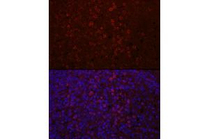 Immunofluorescence analysis of human spleen using CD4 Rabbit pAb (ABIN6134777, ABIN6138187, ABIN6138189 and ABIN6213821) at dilution of 1:100 (40x lens). (CD4 抗体  (AA 300-400))