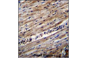 DUS1L Antibody (C-term) (ABIN656451 and ABIN2845736) immunohistochemistry analysis in formalin fixed and paraffin embedded human heart tissue followed by peroxidase conjugation of the secondary antibody and DAB staining. (DUS1L 抗体  (C-Term))