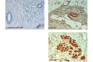 Immunohistochemistry (IHC) image for anti-ATP-Binding Cassette, Sub-Family B (MDR/TAP), Member 5 (ABCB5) (Internal Region) antibody (ABIN349592)