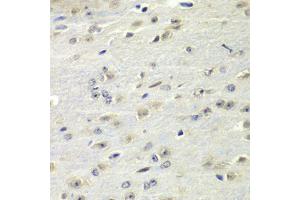 Immunohistochemistry of paraffin-embedded mouse brain using FMR1 Antibody (ABIN5973291) at dilution of 1/100 (40x lens). (FMR1 抗体)