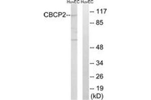 Western blot analysis of extracts from HuvEc cells, using CBCP2 Antibody. (AGBL2 抗体  (AA 731-780))