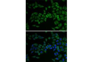 Immunofluorescence (IF) image for anti-E2F Transcription Factor 6 (E2F6) (AA 1-281) antibody (ABIN1679632)
