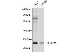 Western blot analysis of extracts of various cell lines, using SLC17 antibody (ABIN7270404) at 1:1000 dilution. (Solute Carrier Family 17 (Acidic Sugar Transporter), Member 5 (SLC17A5) (AA 1-100) 抗体)