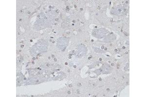 Immunohistochemistry of paraffin-embedded Mouse brain using USP7 Polyclonal Antibody at dilution of 1:100 (40x lens). (USP7 抗体)