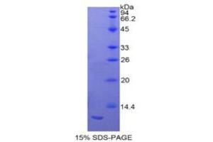 SDS-PAGE analysis of Rat S100A11 Protein. (S100A11 蛋白)
