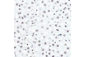 Immunohistochemistry (IHC) image for anti-E74-Like Factor 5 (Ets Domain Transcription Factor) (ELF5) (AA 1-170) antibody (ABIN6140130)
