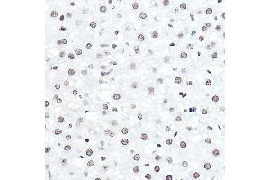 Immunohistochemistry of paraffin-embedded rat liver using ELF5 Rabbit pAb (ABIN6130882, ABIN6140130, ABIN6140131 and ABIN6222999) at dilution of 1:50 (40x lens). (ELF5 抗体  (AA 1-170))