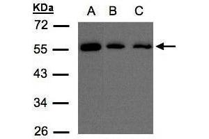 WB Image Sample(30 μg of whole cell lysate) A:H1299 B:Hep G2, C:MOLT4 , 10% SDS PAGE antibody diluted at 1:500 (OSBPL2 抗体  (C-Term))
