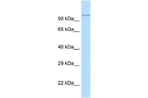WB Suggested Anti-Adam29 Antibody   Titration: 1. (ADAM29 抗体  (N-Term))
