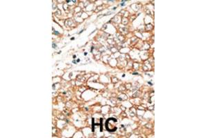 Immunohistochemistry (IHC) image for anti-BCL2-Related Ovarian Killer (BOK) (BH3 Domain) antibody (ABIN2997148) (BOK 抗体  (BH3 Domain))