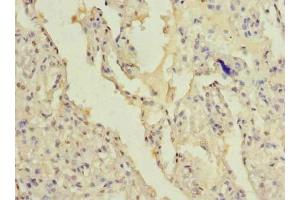 Immunohistochemistry of paraffin-embedded human lung tissue using ABIN7165382 at dilution of 1:100 (FAM124B 抗体  (AA 146-272))