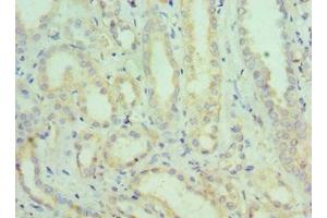 Immunohistochemistry of paraffin-embedded human kidney tissue using ABIN7168831 at dilution of 1:100 (SEMG1 抗体  (AA 24-310))