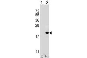 Western blot analysis of UBE2V1 antibody and 293 cell lysate (2 ug/lane) either nontransfected (Lane 1) or transiently transfected (2) with the UBE2V1 gene. (UBE2V1 抗体  (AA 113-145))