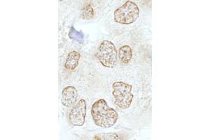 Immunohistochemistry (IHC) image for anti-SSB1 (AA 161-211) antibody (ABIN7448816) (SSB1 (AA 161-211) 抗体)