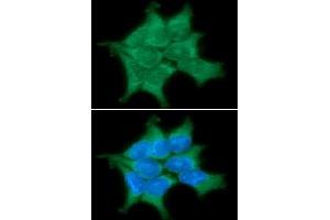 ICC/IF analysis of PPM1G in 293T cells line, stained with DAPI (Blue) for nucleus staining and monoclonal anti-human PPM1G antibody (1:100) with goat anti-mouse IgG-Alexa fluor 488 conjugate (Green) (PPM1G 抗体)