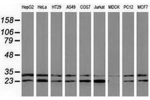 Western Blotting (WB) image for anti-ClpP Caseinolytic Peptidase, ATP-Dependent, Proteolytic Subunit Homolog (E. Coli) (CLPP) antibody (ABIN2718668)
