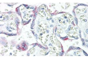 Detection of KISS1 in Human Placenta Tissue using Monoclonal Antibody to Kisspeptin 1 (KISS1) (KISS1 抗体  (AA 20-138))